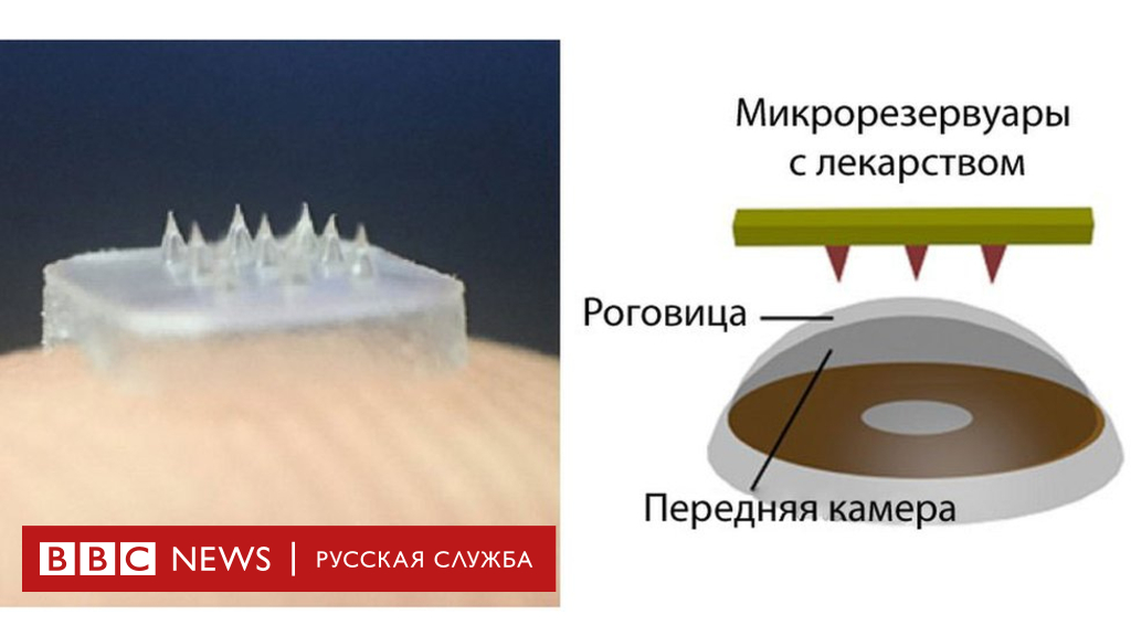 104308777 eye patch with spikes on it 1 Новости BBC