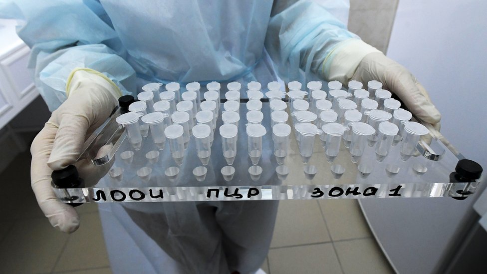 111118634 c0482507 testing for covid 19 infection spl коронавирус в Абхазии коронавирус в Абхазии