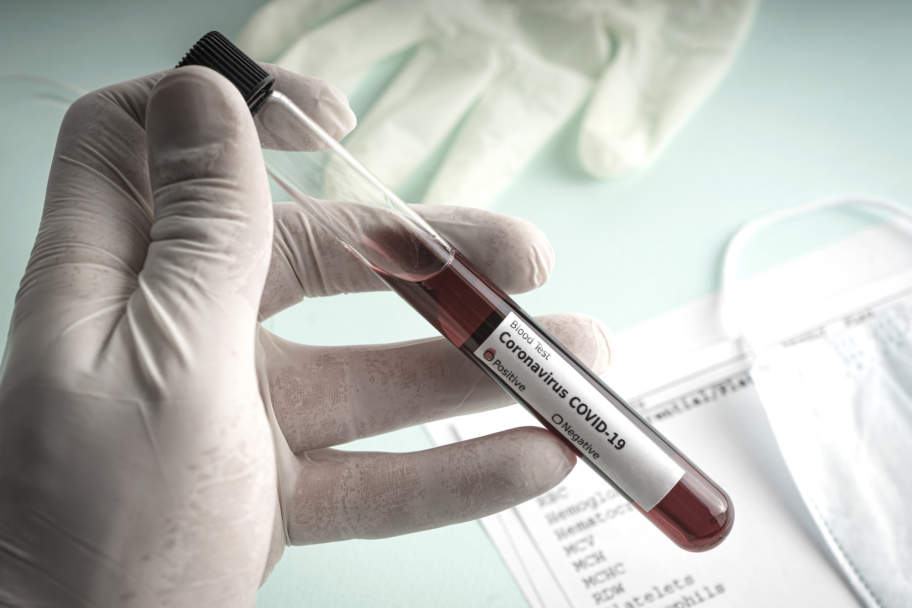 hand in gloves holds a test tube containing a bloo AKDRVWL новости Covid-19, коронавирус в Грузии, статистика
