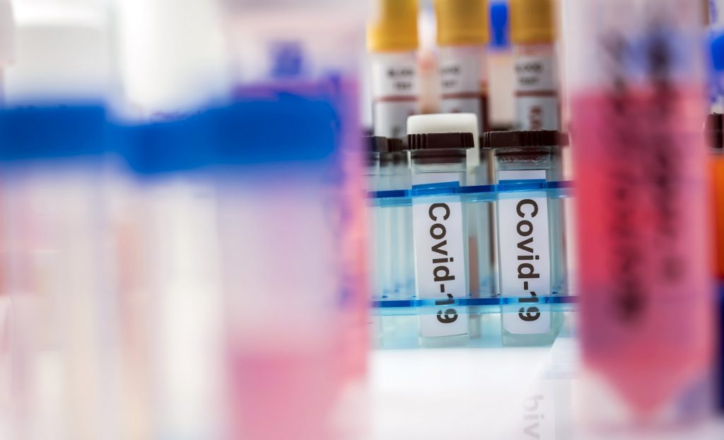 vials with samples of sars cov 2 covid 19 in a res NR6HBA9 новости Covid-19, коронавирус в Грузии, статистика