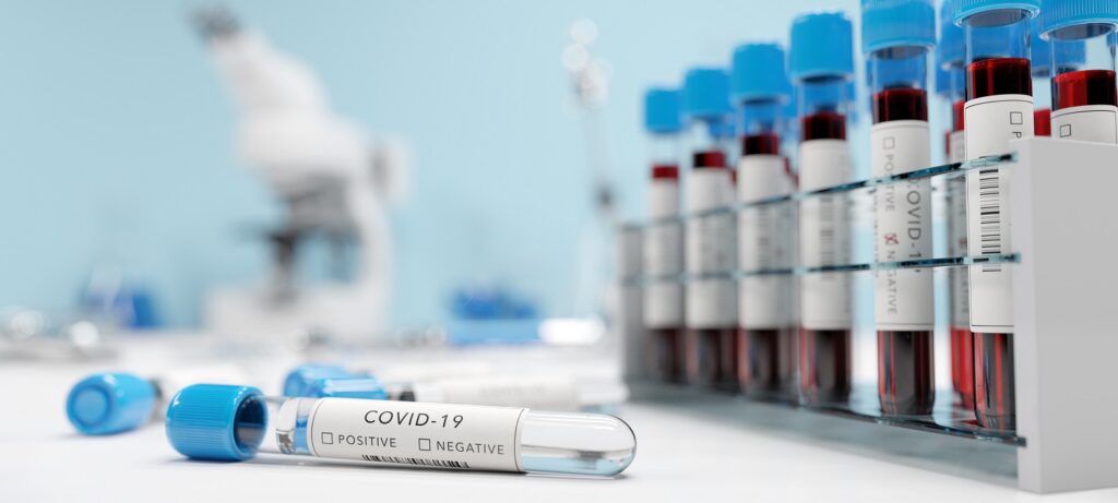 testing for coronavirus covid 19 in a lab covid m 2021 08 28 20 03 53 utc новости Covid-19, коронавирус в Грузии