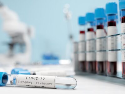 testing for coronavirus covid 19 in a lab covid m 2021 08 28 20 03 53 utc фоторепортаж Covid-19, коронавирус, коронавирус в Грузии