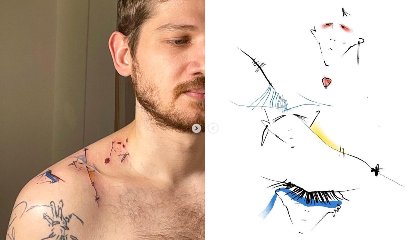 Удаление лазером татуировок в Нальчике