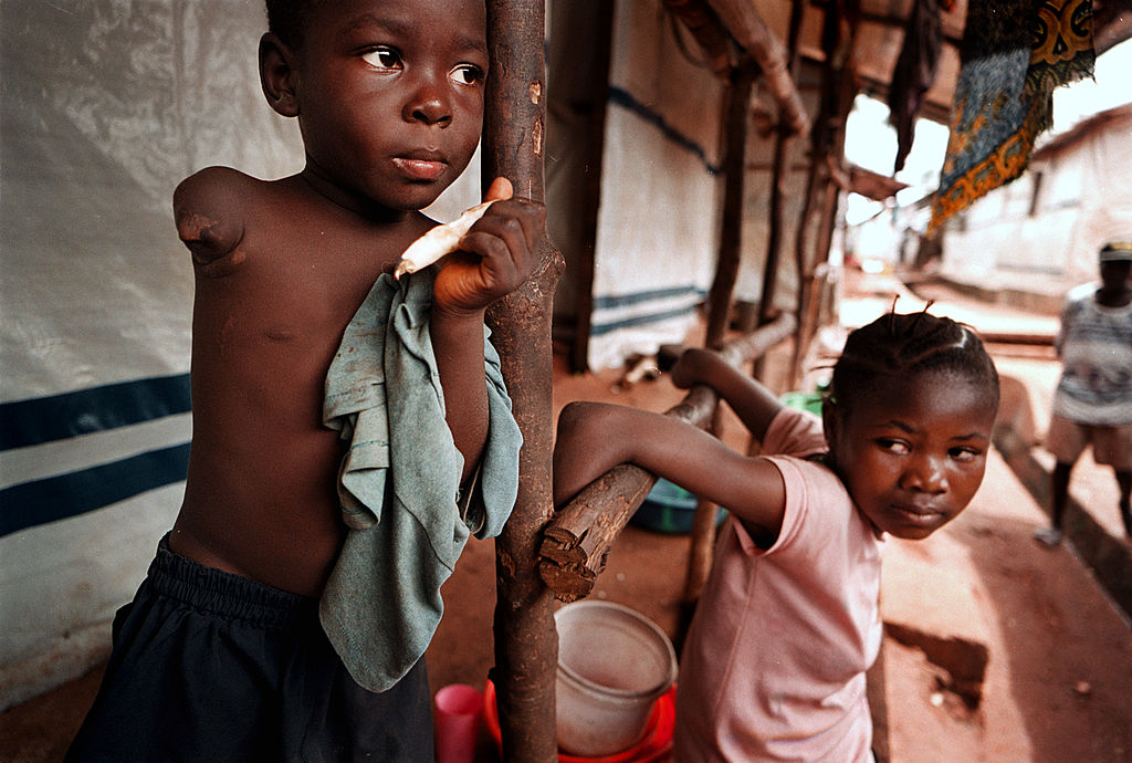 Покалеченные дети в Сьерра-Леоне