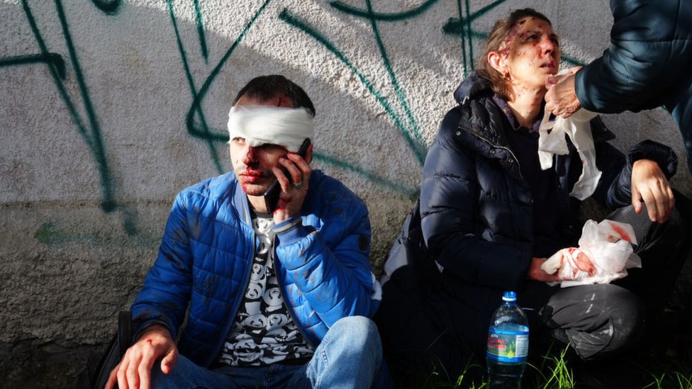 Раненые в результате ракетной атаки на Киев