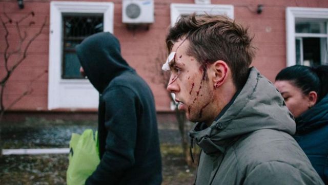 Раненый мужчина в Харькове