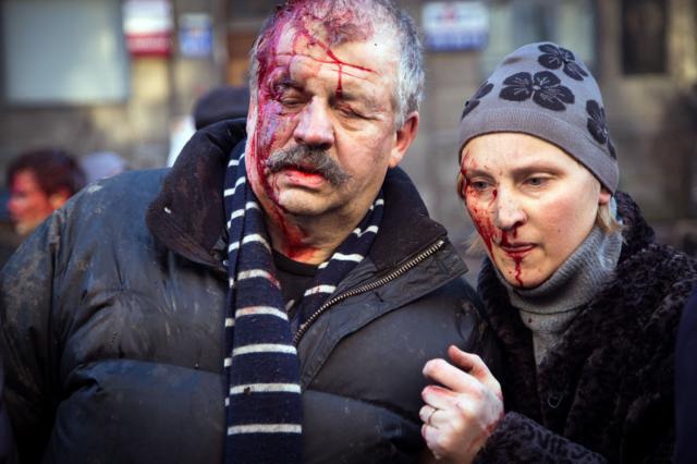 Раненая пара в Киеве