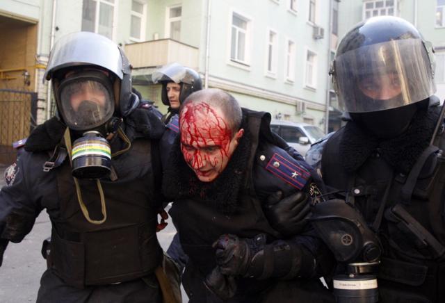 Раненый милиционер в Киеве